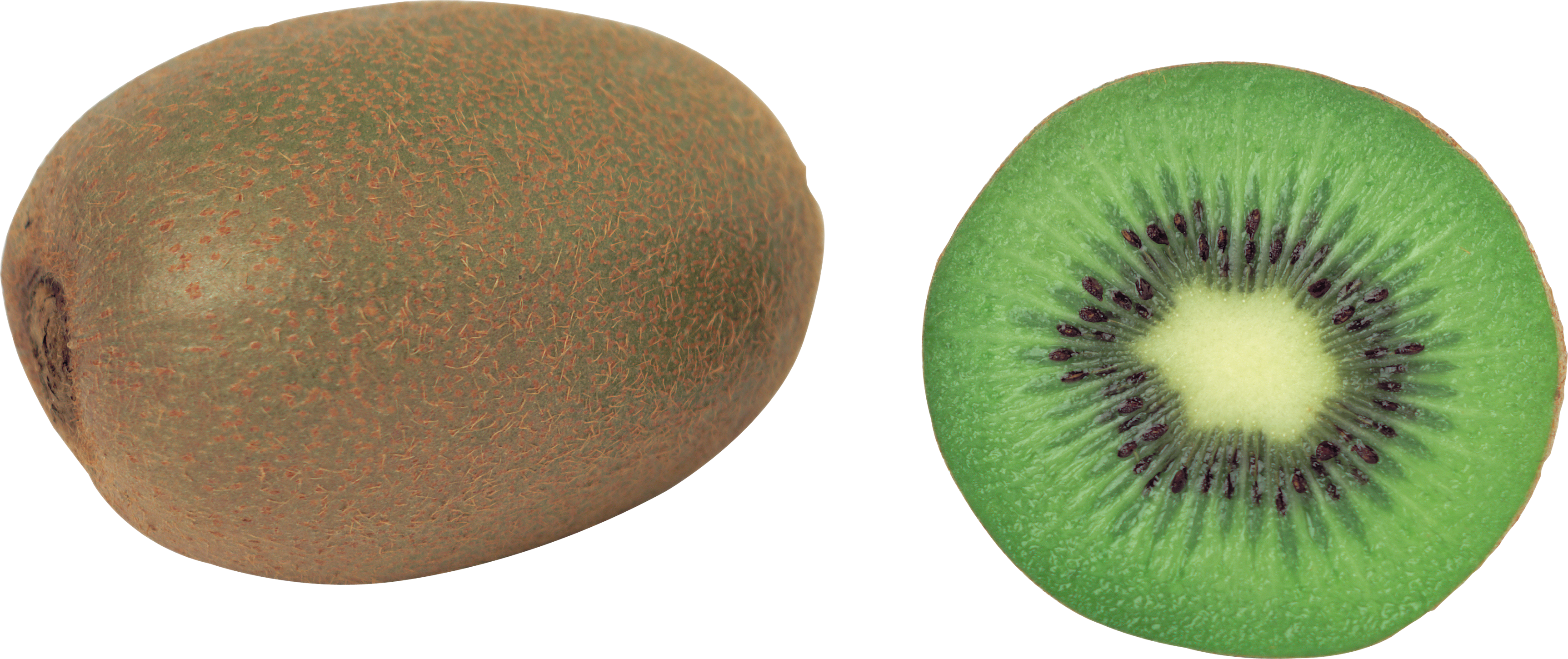 Quả kiwi