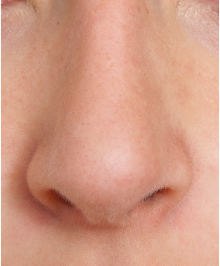 Ludzki nos