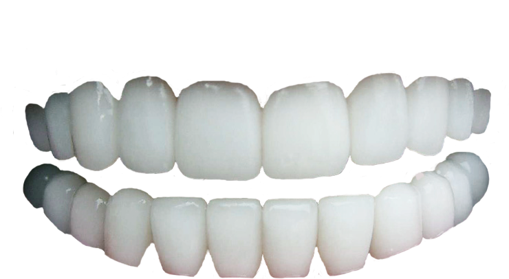 Diş